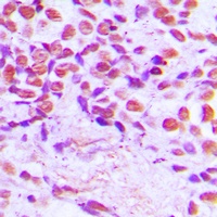 Anti-SENP3 Antibody