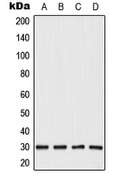 CBP86 Rabbit Polyclonal Antibody