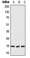 DUX5 Rabbit Polyclonal Antibody