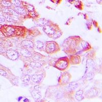 Anti-STEAP1 Antibody