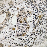Anti-HBP1 (Phospho-S402) Antibody