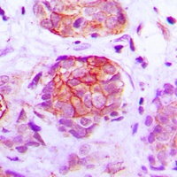 Anti-GPR160 Antibody