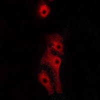 Anti-GPR160 Antibody
