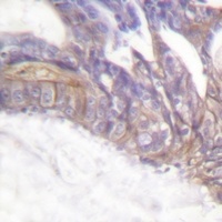 Anti-LAT (Phospho-Y191) Antibody