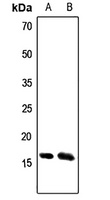 ATP5S Antibody