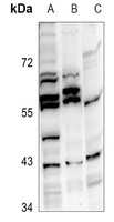 GPR81 Rabbit Polyclonal Antibody
