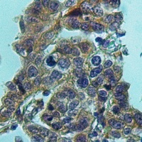 Anti-HPGDS Antibody