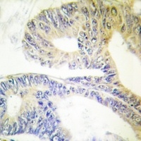 ZNF638 antibody