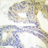 Anti-ZNF638 Antibody