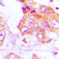 Anti-GIT1 Antibody