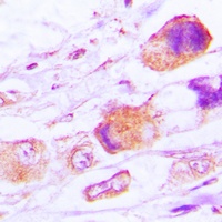 Anti-MRPL15 Antibody