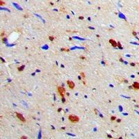 MGCRACGAP Antibody