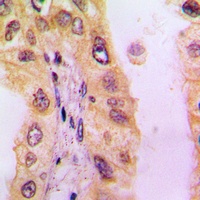 BLNK Antibody