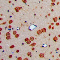 Anti-Fibulin 4 Antibody