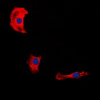 Anti-Fibulin 4 Antibody