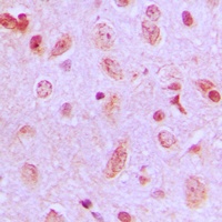 Anti-ZDHHC9 Antibody