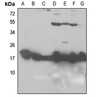RPL26L1 Antibody