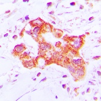 Anti-Cytochrome P450 39A1 Antibody