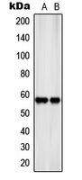 SLC22A17 Antibody