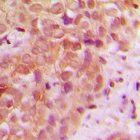 Anti-UBR5 Antibody