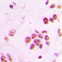 Anti-IP6K2 Antibody