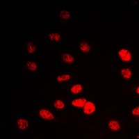 Anti-IP6K2 Antibody