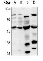 PPHLN1 Antibody