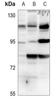 Histone Deacetylase 7 Rabbit Polyclonal Antibody