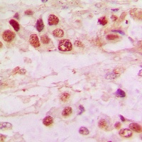 Histone Deacetylase 7 Rabbit Polyclonal Antibody