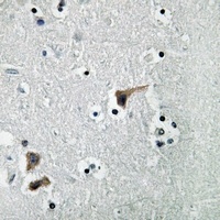 Anti-ATP6V1H Antibody