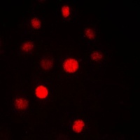 Anti-SAP14 Antibody