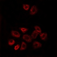 Anti-GPRC5B Antibody