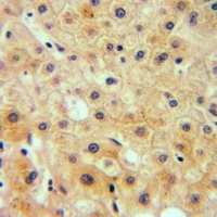 Anti-RAB23 Antibody