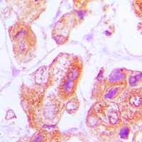 Anti-DNAJB11 Antibody