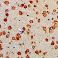Anti-ERAP1 Antibody
