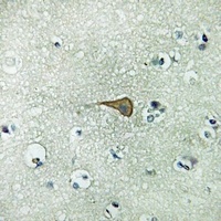 Anti-IL-20RA Antibody