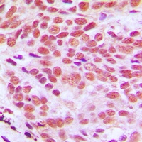 Anti-Histone H2B Antibody