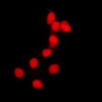 Anti-Histone H2B Antibody