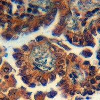 Anti-GPR173 Antibody