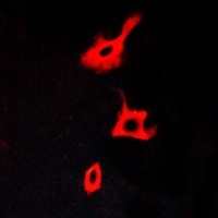 Anti-GPR173 Antibody