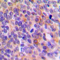 Anti-TOLLIP Antibody