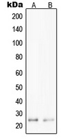 PPP1R14D Antibody