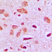 PPP1R14D Antibody
