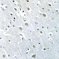 Anti-PIGX Antibody