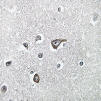 Anti-MRPL20 Antibody