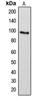 ARHGAP17 Antibody