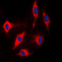 Anti-ARHGAP17 Antibody