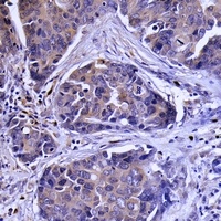 SLC6A15 antibody