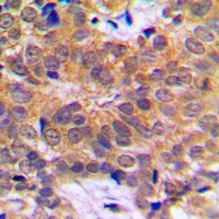 Anti-RCBTB1 Antibody