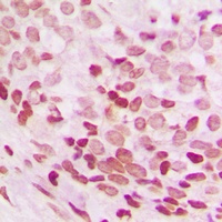Anti-NEIL3 Antibody